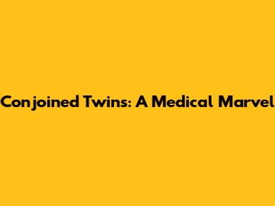 Conjoined Twins: A Medical Marvel