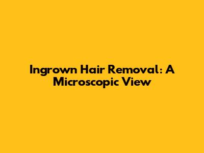 Ingrown Hair Removal: A Microscopic View