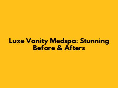 Luxe Vanity Medspa: Stunning Before & Afters