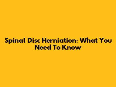 Spinal Disc Herniation: What You Need To Know