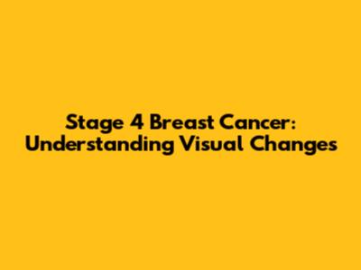 Stage 4 Breast Cancer: Understanding Visual Changes