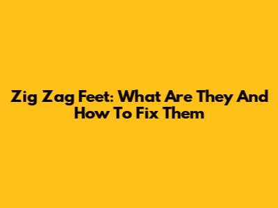 Zig Zag Feet: What Are They And How To Fix Them